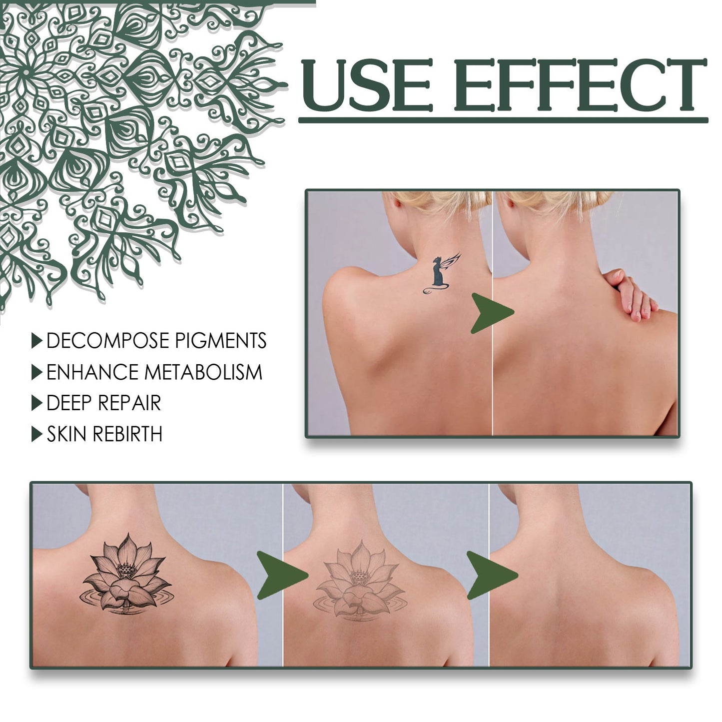 South Moon Green Algae Tattoo Remover Tattoo Cleansing Diminishes Tattoos Cleans the Body Gentle and Non-irritating 