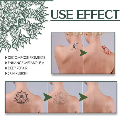 South Moon Green Algae Tattoo Remover Tattoo Cleansing Diminishes Tattoos Cleans the Body Gentle and Non-irritating 