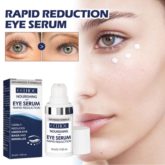 EELHOE Eye Repair Essence បំបាត់ស្នាមជ្រួញកន្ទុយភ្នែក ផ្តល់សំណើម និងជួសជុលស្បែក រឹតបន្តឹង លើក និងរលោង 