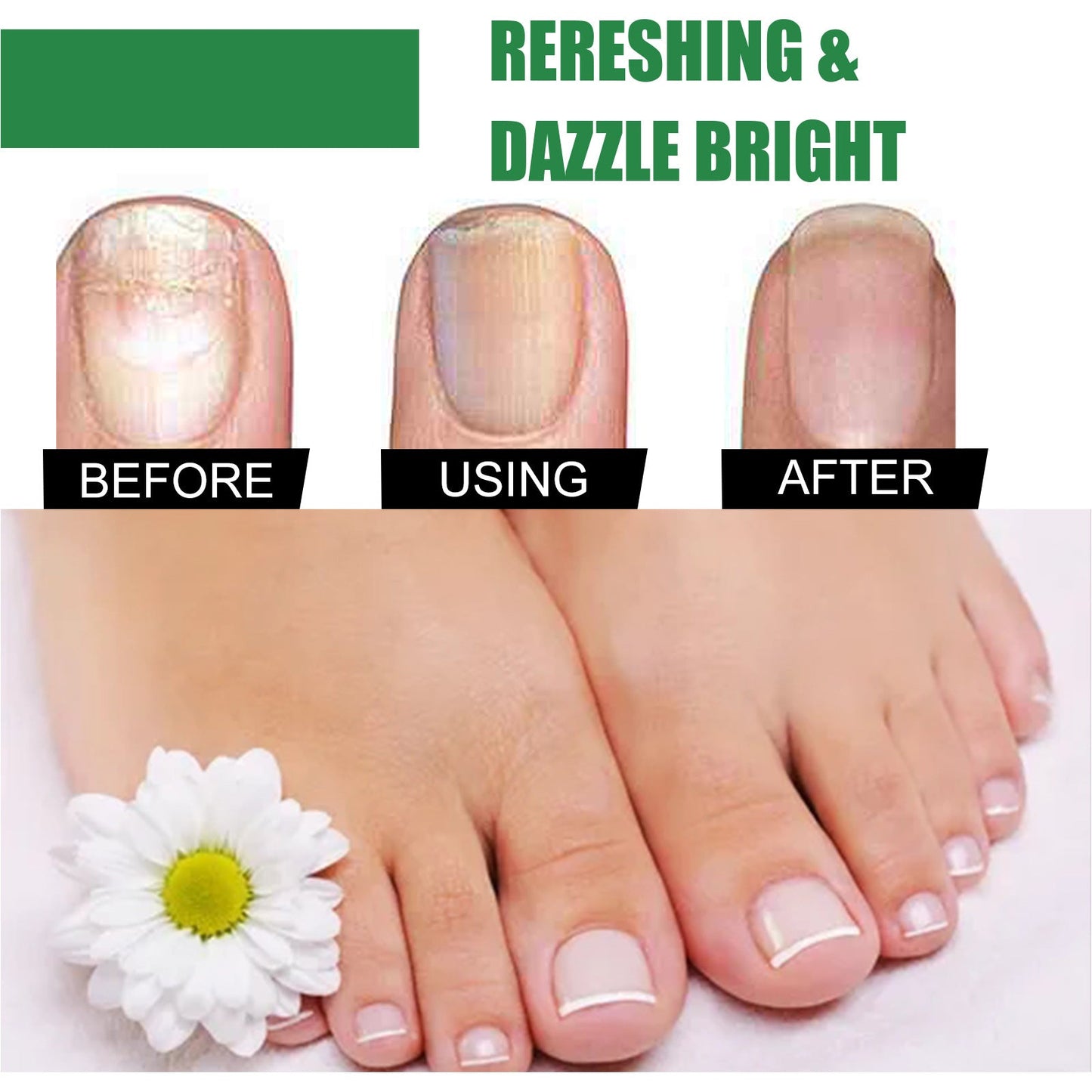 EELHOE onychomycosis repair liquid toenail tea tree oil finger thick soft nail nutrition hand and foot nail care liquid 