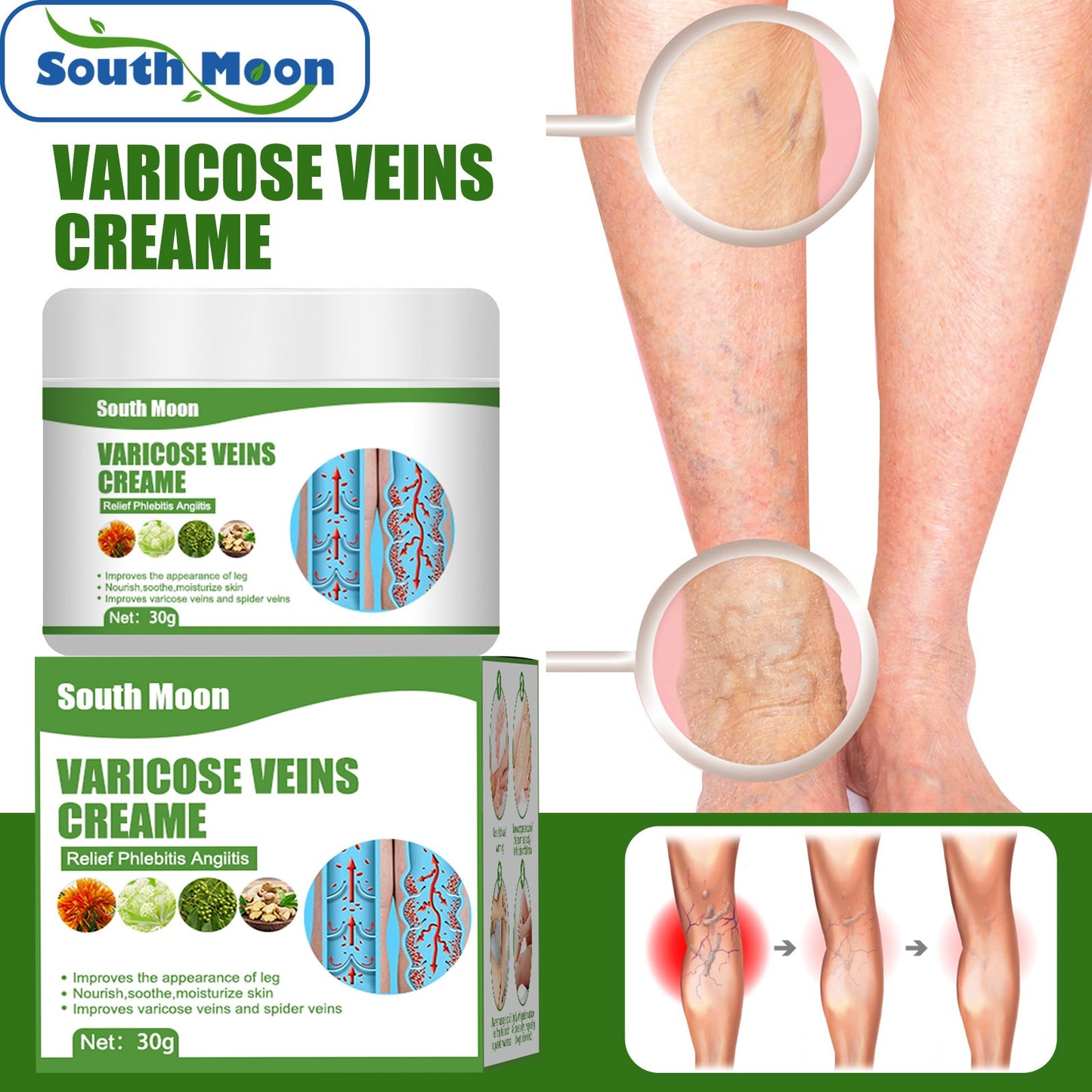 South Moon Varicose Repair Cream Legs Earthworms Leg Veins Relief Pain Leg Care Massage Cream 