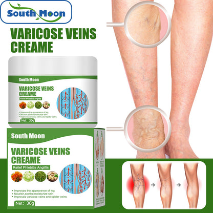 South Moon Varicose Vein Repair Cream Legs Earthworm Legs Blue Veins Raised Relieve Pain Leg Care Massage Cream 