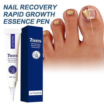 Jaysuing 7-Day Nail Repair Essence Hand and Foot Nail Care Broken Toenails Brightening Nails Onychomycosis Nail Repair Solution 