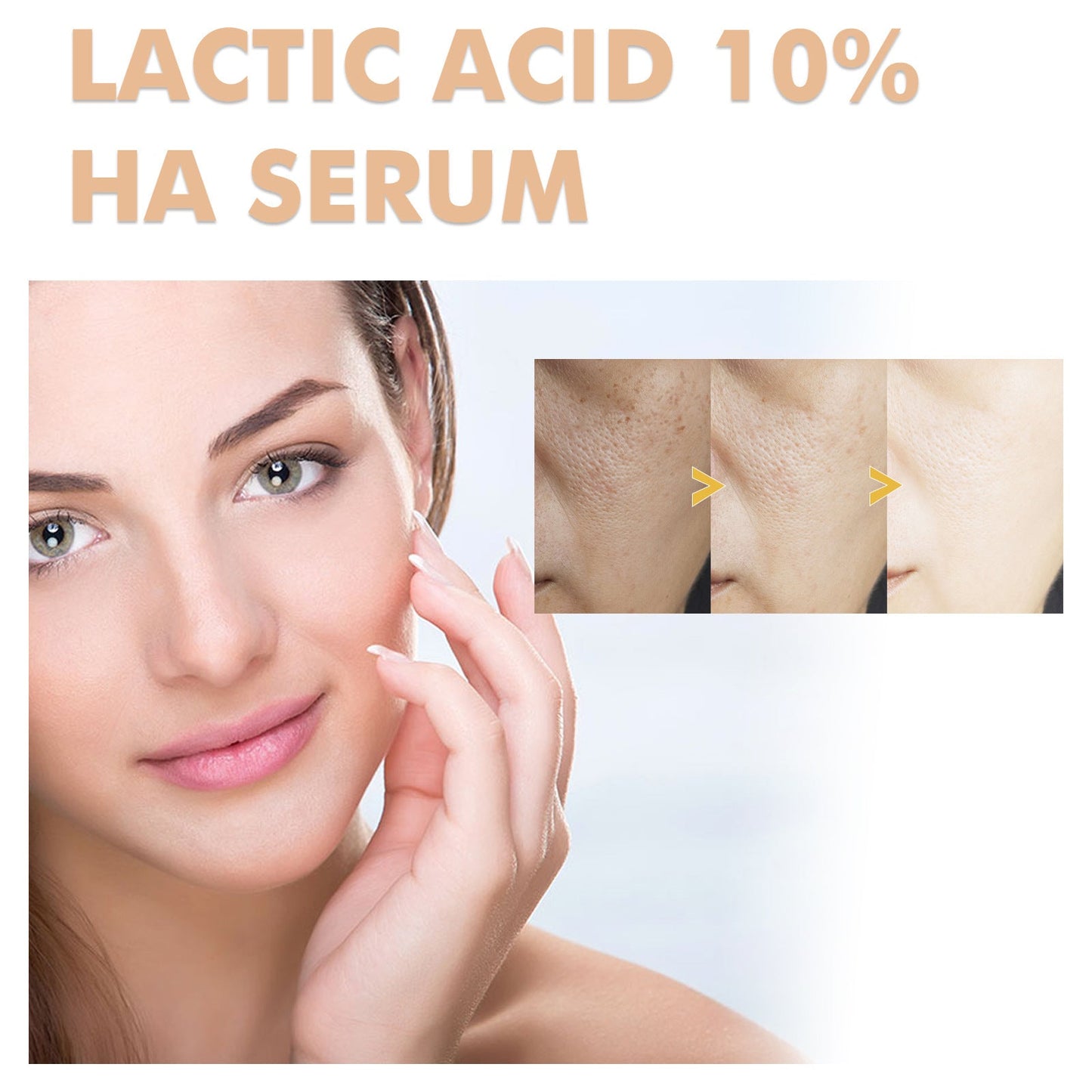 Hoygi lactic acid facial essence fades acne and blackheads, anti-wrinkle, moisturizing, whitening and anti-aging 