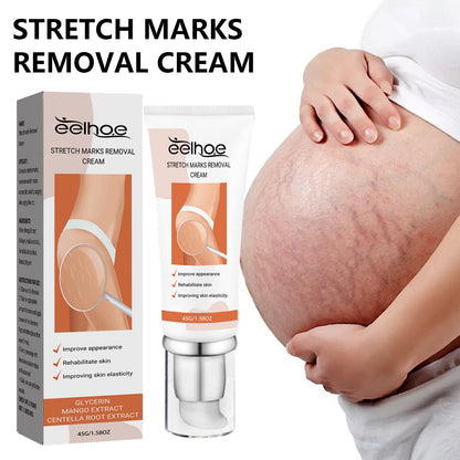 EELHOE Pregnancy Scar Repair Cream Fades Body Skin Pregnancy Scar Repair Smoothing Rejuvenation Care Cream 