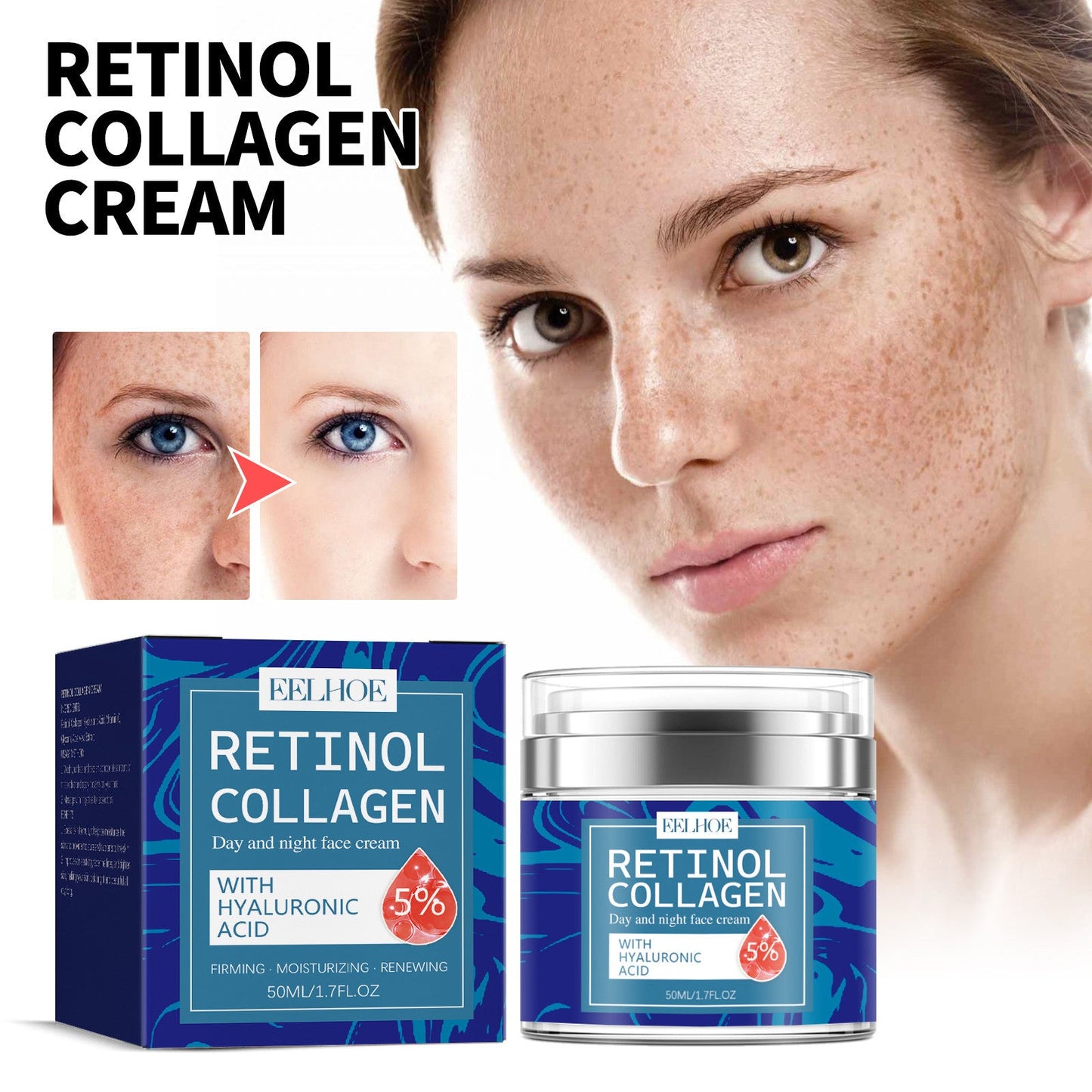 EELHOE Retinol Collagen Cream បំបាត់ស្នាមជ្រីវជ្រួញ មេឡានីន បន្តឹងស្បែក ធ្វើអោយស្បែកស ម៉ដ្ឋរលោង ក្រែមផ្តល់សំណើម 