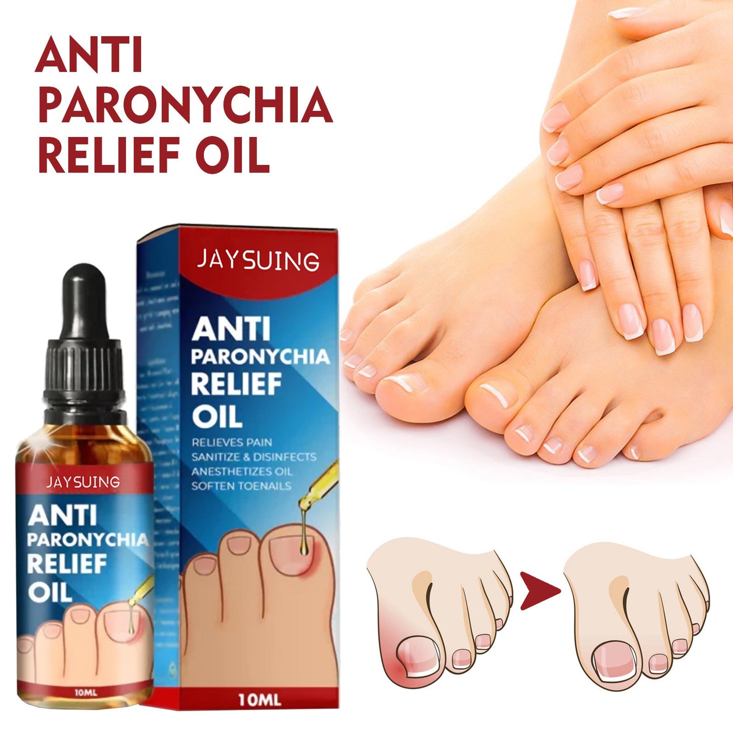 Jaysuing Anti-nail groove relief oil Soft nails Bright nails Repair ingrown nails Thickening type onychomycosis nail groove care oil 