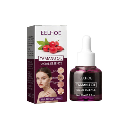 EELHOE Tamanu Facial Oil បំបាត់ស្នាមមុន បិទបាំងស្នាម ផ្តល់សំណើម ផ្តល់សំណើម និងបន្តឹងស្បែក ប្រេងសំខាន់ៗ 