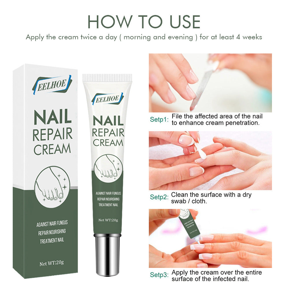 EELHOE nail care cream onychomycosis hand and foot care thickening onychomycosis clean soft nail cream 