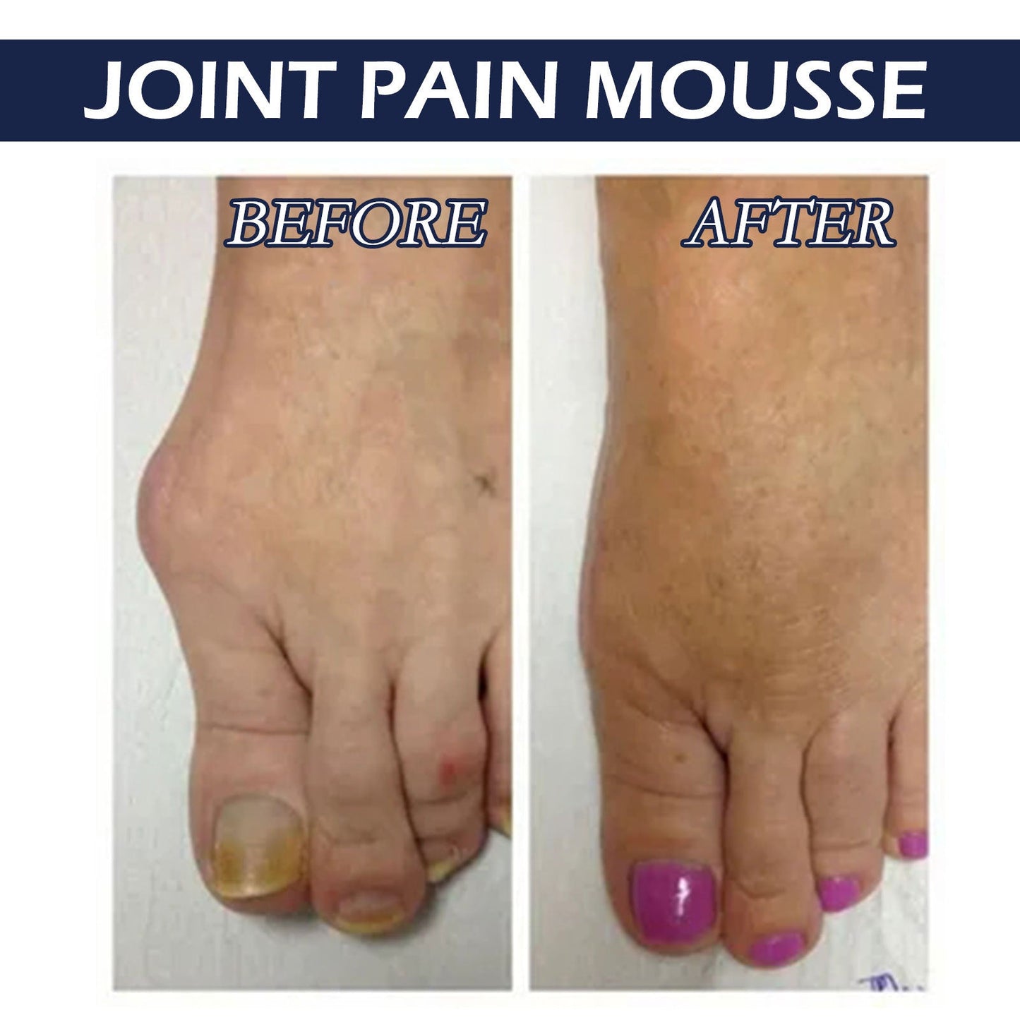 South Moon joint care mousse relieves wrist pain cervical vertebrae and knee joint body massage care cream 