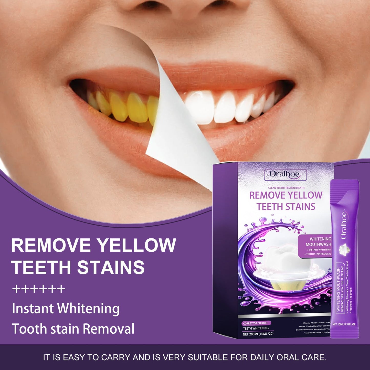 ORALHOE purple whitening mouthwash teeth cleaning yellow teeth stains whitening fresh breath oral care 