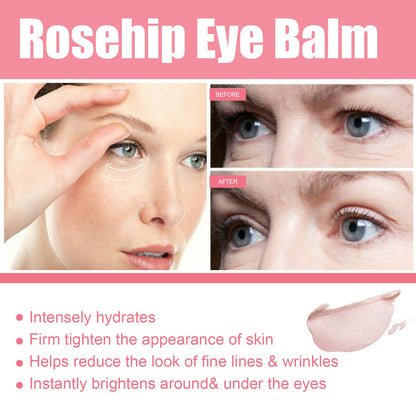 West&amp;Month Rosehip Eye Cream Stick reduces eye bags and fine lines around the eyes, moisturizes and tightens the skin around the eyes 