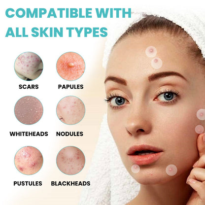 West&amp;Month Acne Patch Repairs Acne Pimples Cleans Pores Invisible Breathable Concealer Waterproof Acne Cleansing Patch 