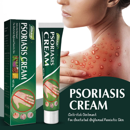 South Moon Psoriasis Cream Repairs Psoriasis Hand and Foot Moss Relieves Itching Antipruritic Cream Skin Topical Ointment 