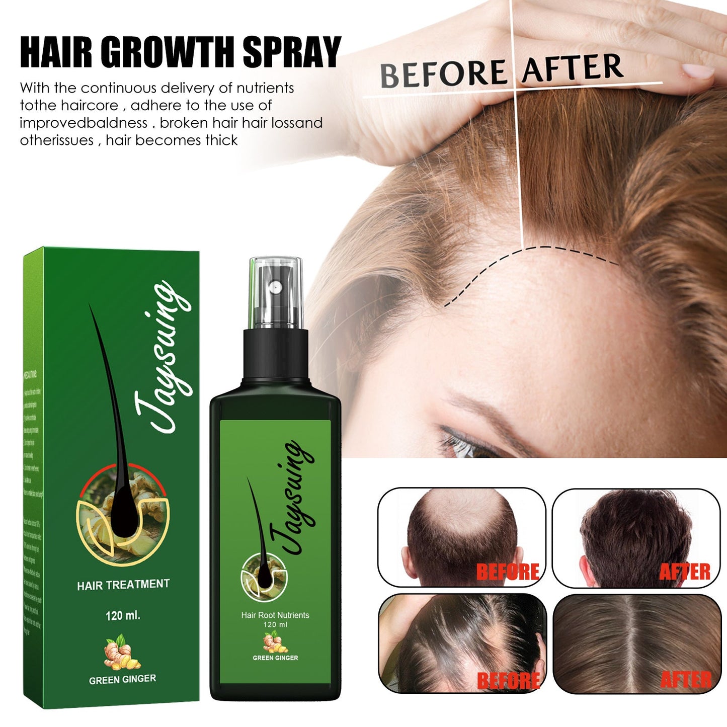 Jaysuing Hair Thickness Serum បណ្តុះសក់ ដុះក្រាស់ ចិញ្ចឹមឫសសក់ ពង្រឹងស្បែកក្បាល ម៉ាស្សា សារធាតុចិញ្ចឹម 