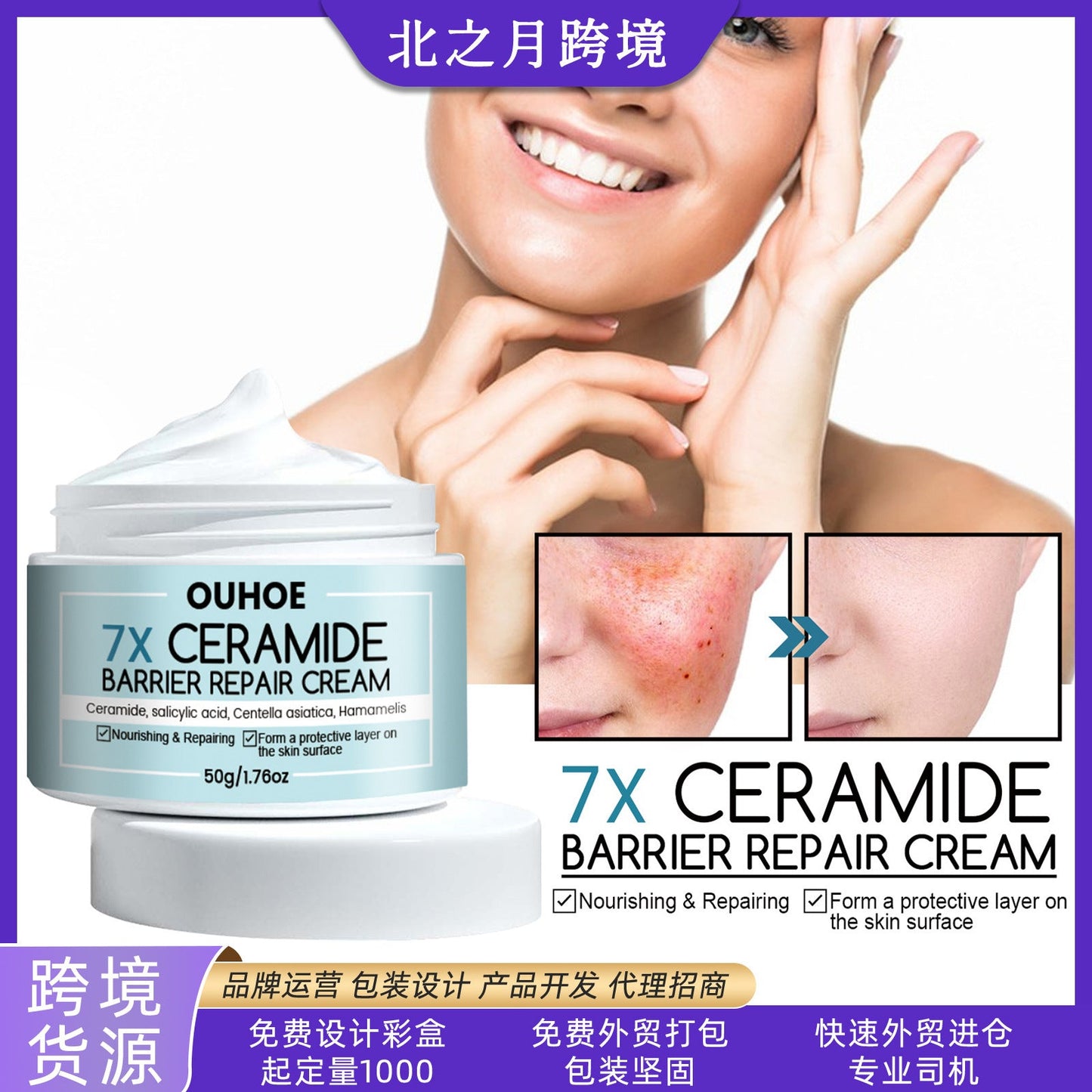 OUHOE ceramide repair cream moisturizes and hydrates the skin, repairs the skin barrier, brightens the skin, and rejuvenates the skin. Moisturizing cream 