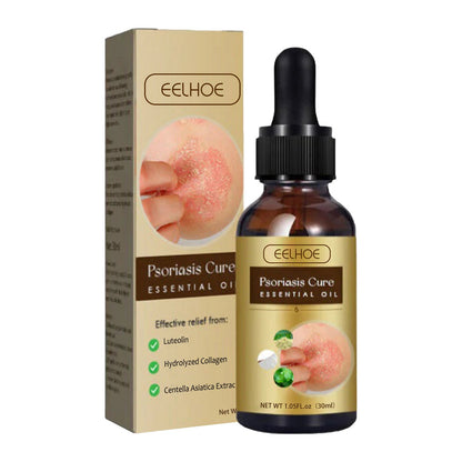 EELHOE skin moss repair essential oil relieves skin itching and swelling, hands and feet moss external care essential oil 