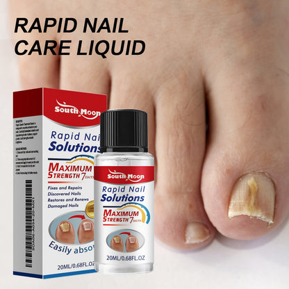 South Moon Nail Care Essence Thickening Onychomycosis Repair Repair Yellow Hand and Feet Moisturizing Care Solution 