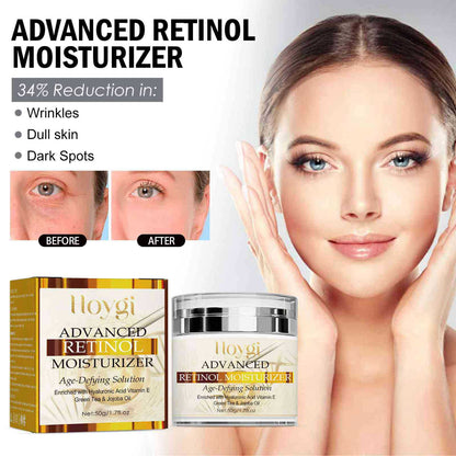 Hoygi Retinol Cream បំបាត់ស្នាមជ្រួញ បន្តឹងស្បែកមុខ ធ្វើអោយស្បែកភ្លឺថ្លា ជួសជុល និងផ្តល់សំណើម 