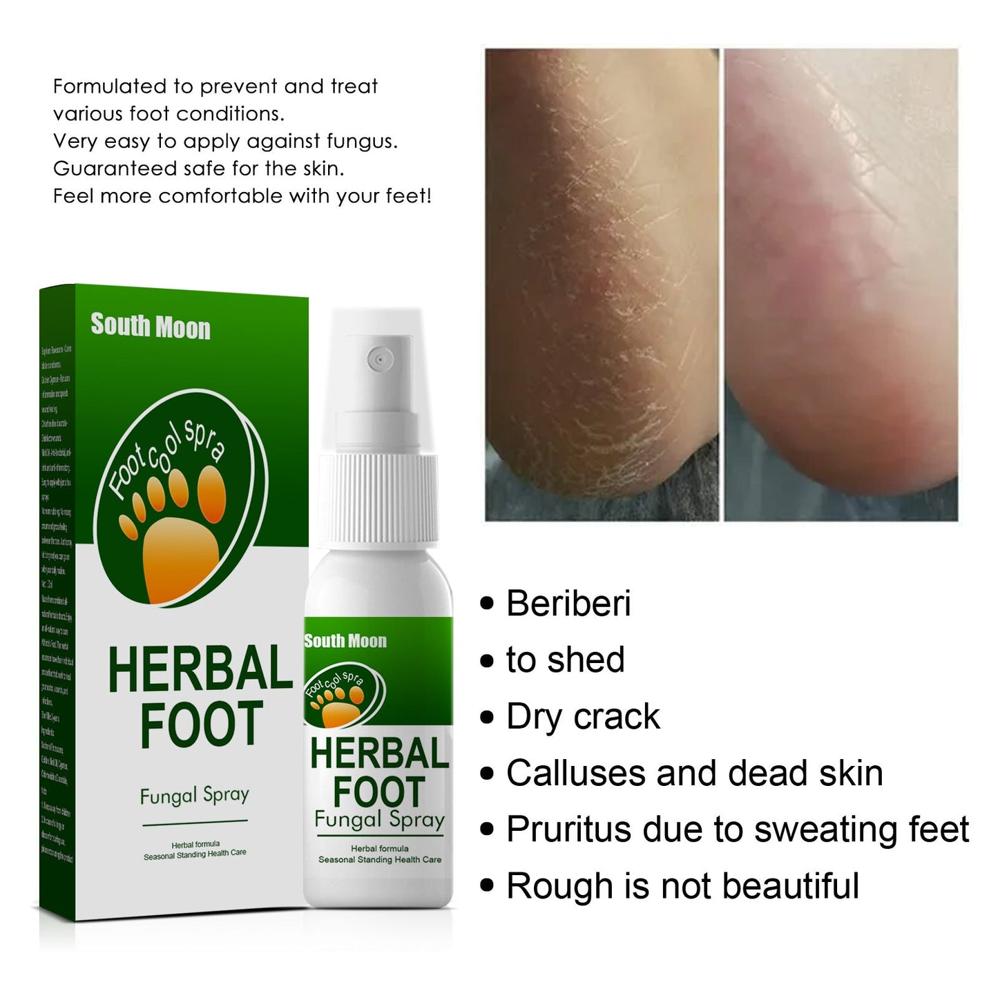 South Moon Herbal Foot Spray Anti-itching Athlete's Foot Spray Removes Odor Peeling Foot Care Spray 