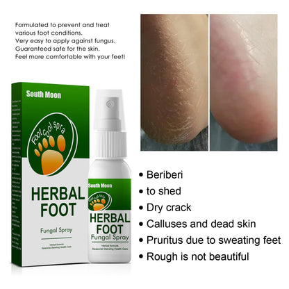 South Moon Herbal Foot Spray បាញ់បំបាត់ការរមាស់ជើងរបស់អត្តពលិក Deodorizing Peeling Foot Care Spray 