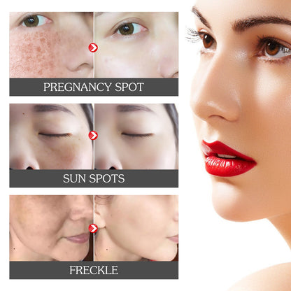 Jaysuing dark spot removal facial essence fades spots and spots to remove melanin and brighten skin tone. 