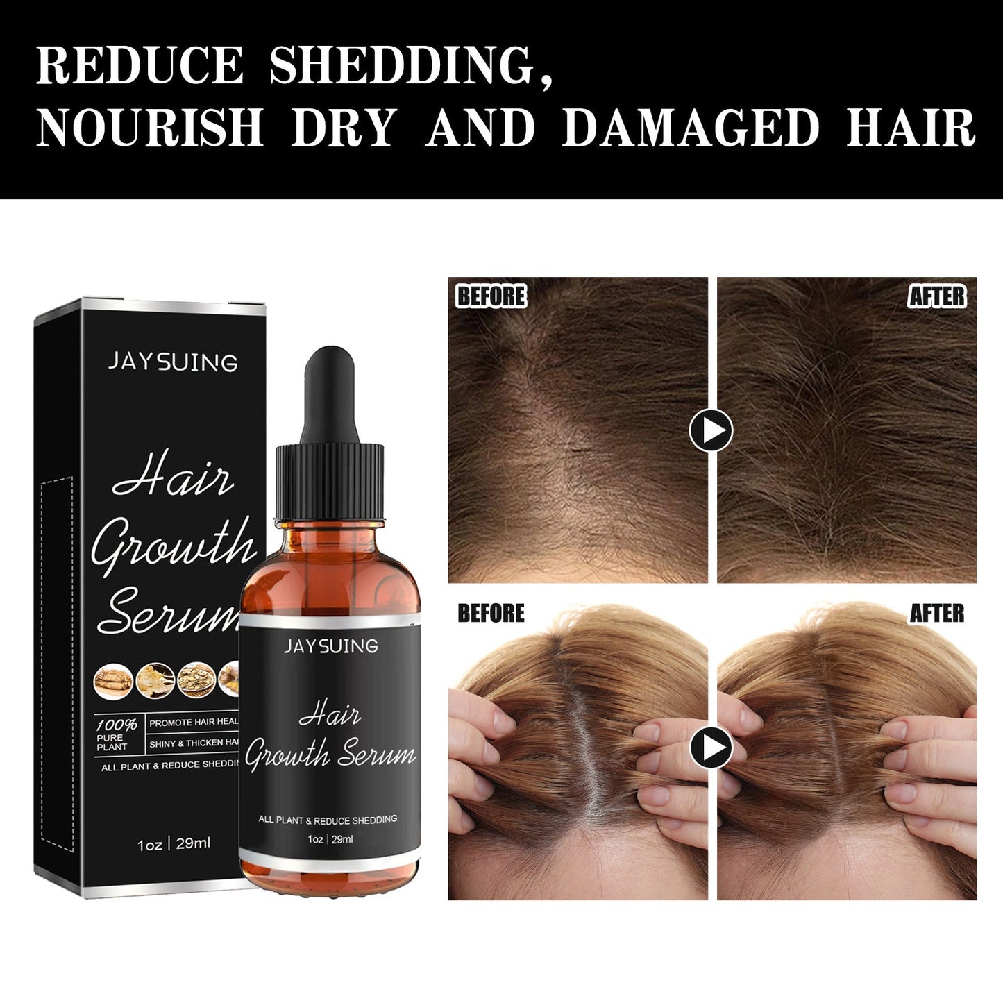 Jaysuing Thick Hair Essence ពង្រឹងសក់ ជួសជុលឫសសក់ ផ្តល់សំណើម សក់ក្រាស់ សក់ក្រាស់ 