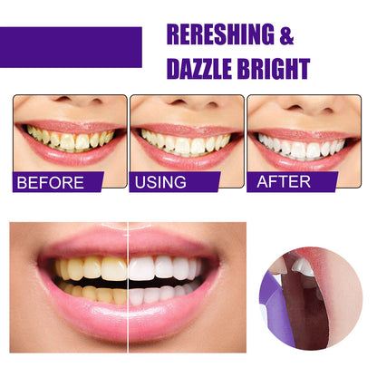 ថ្នាំដុសធ្មេញ Jaysuingv34 Whitening Toothpaste ថ្នាំដុសធ្មេញ Whitening Orthodontics សម្អាតធ្មេញលឿង ស្នាមប្រឡាក់ ថ្នាំដុសធ្មេញ 