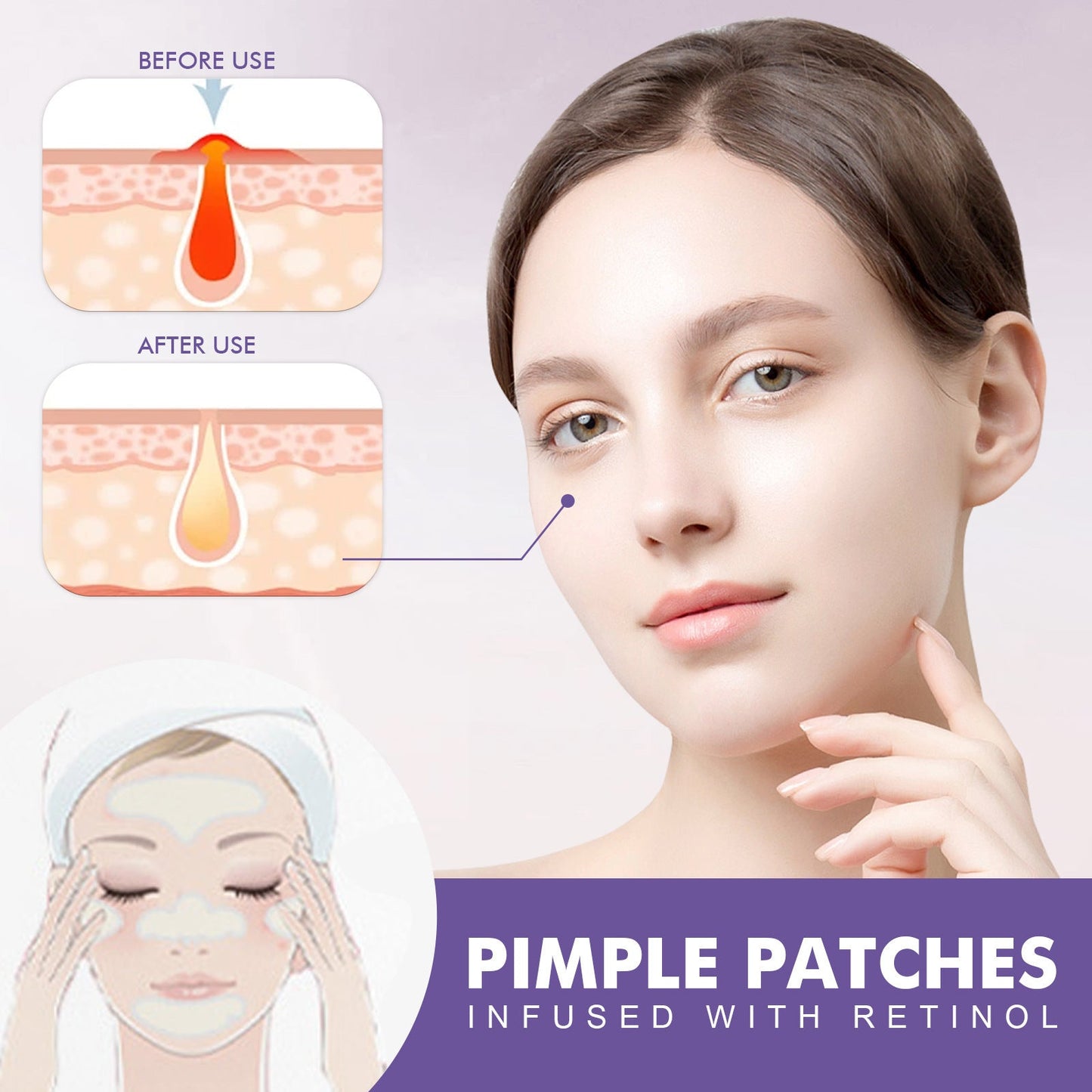 EELHOE Cheek acne patch salicylic acid anti-acne fade acne marks acne closed mild cleansing acne patch 