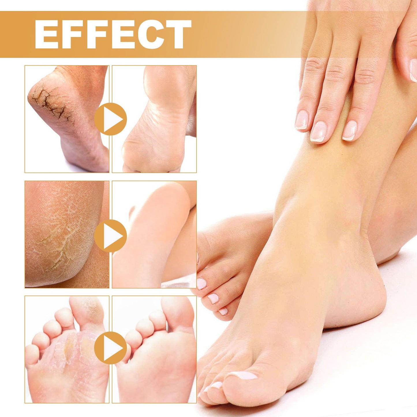 OUHOE foot spray cleans cuticles, calluses, dead skin, prevents dryness and cracks, repairs rough skin, moisturizing care spray 