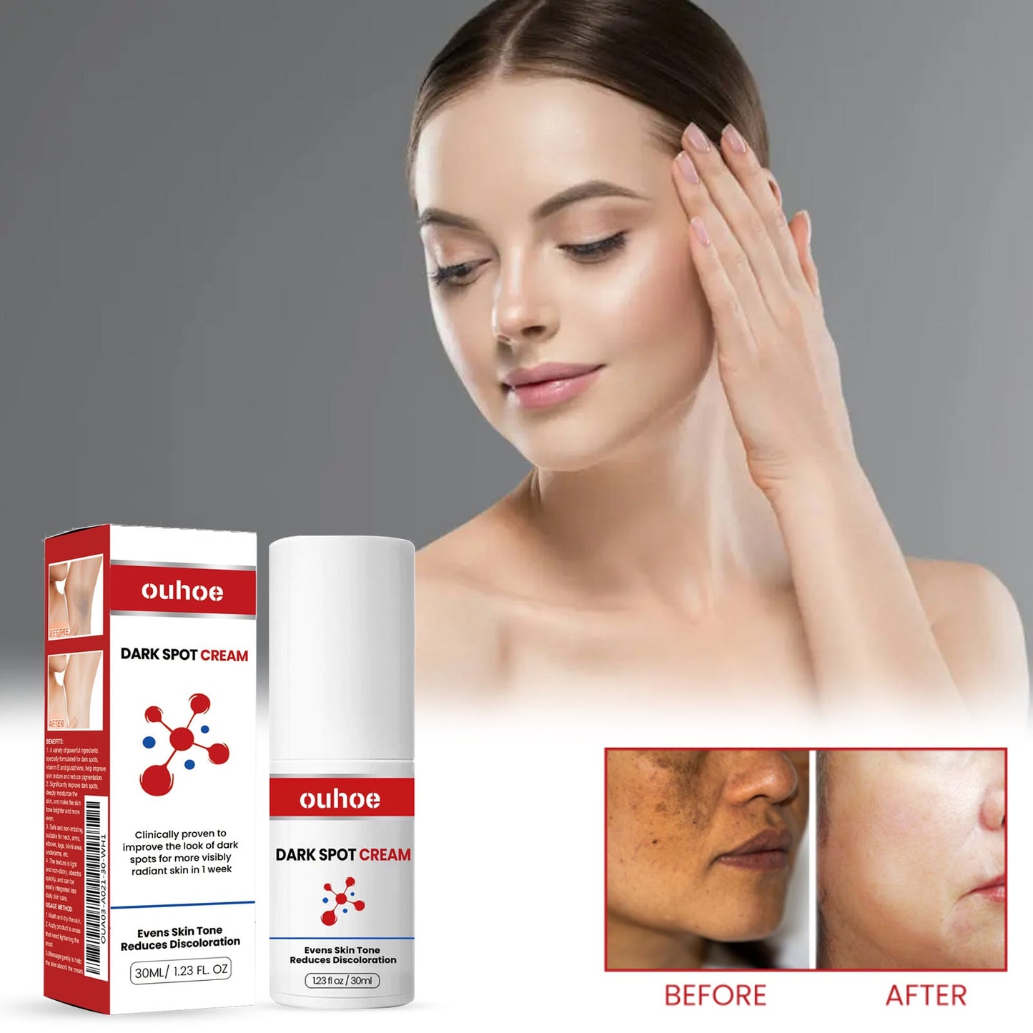 OUHOE Dark Spot Repair Cream ធ្វើអោយស្បែកស ជួសជុលស្បែកខ្មៅស្រអាប់ កាត់បន្ថយស្នាមអុចខ្មៅ គ្រីមជួសជុលស្នាមអុចខ្មៅ 