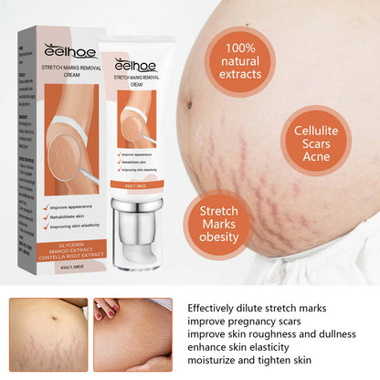 EELHOE pregnancy scar repair cream lightens body skin pregnancy scar repair smoothing and tender skin care cream 