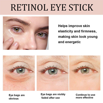 West&amp;Month Retinol Anti-Wrinkle Eye Cream Stick reduces fine lines around the eyes, moisturizes, lifts, tightens, and is delicate and skin-friendly 