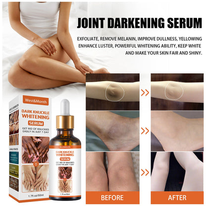 West&amp;Month joint darkening skin care solution knee ankle corner brightens skin tone moisturizes melanin 