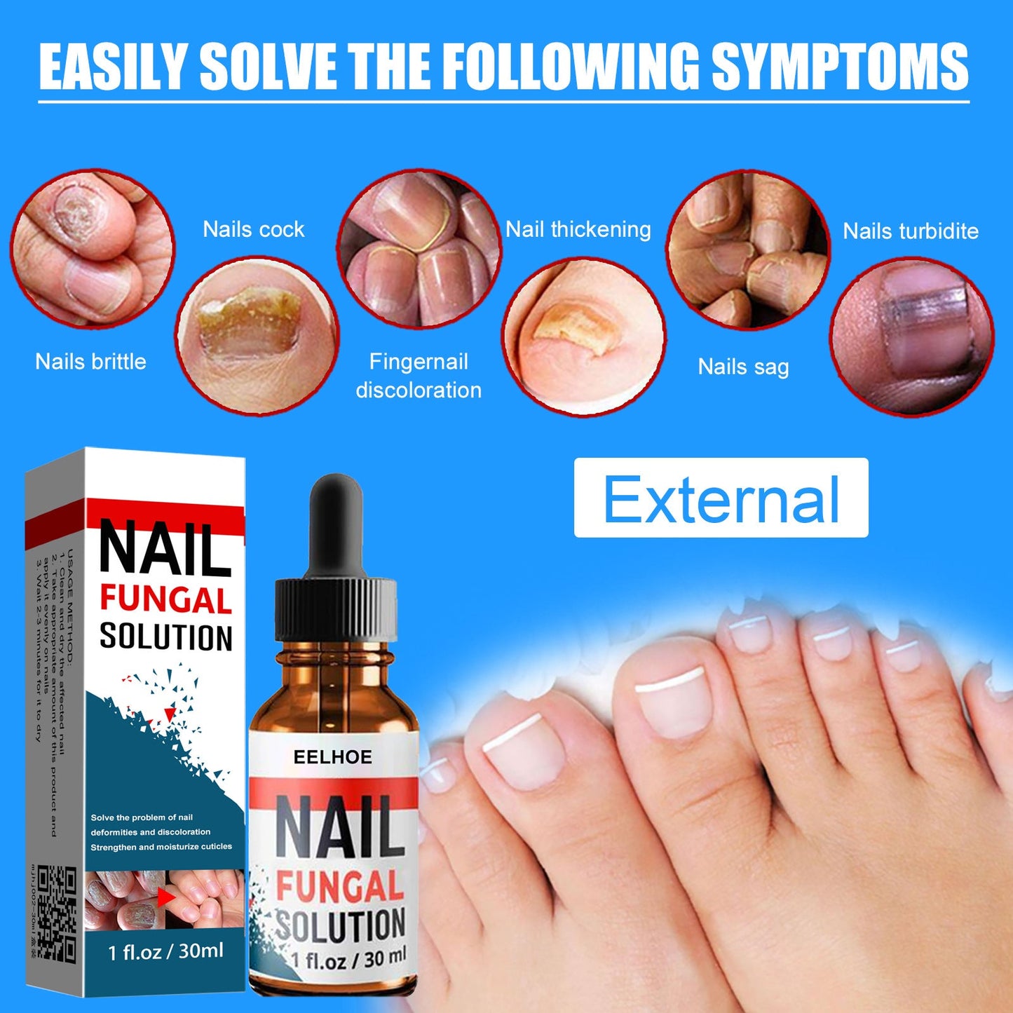 EELHOE nail repair liquid hand and foot onychomycosis care repair onychomycosis liquid thickening soft nail 