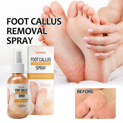 OUHOE foot spray cleans cuticles, calluses, dead skin, prevents dryness and cracks, repairs rough skin, moisturizing care spray 