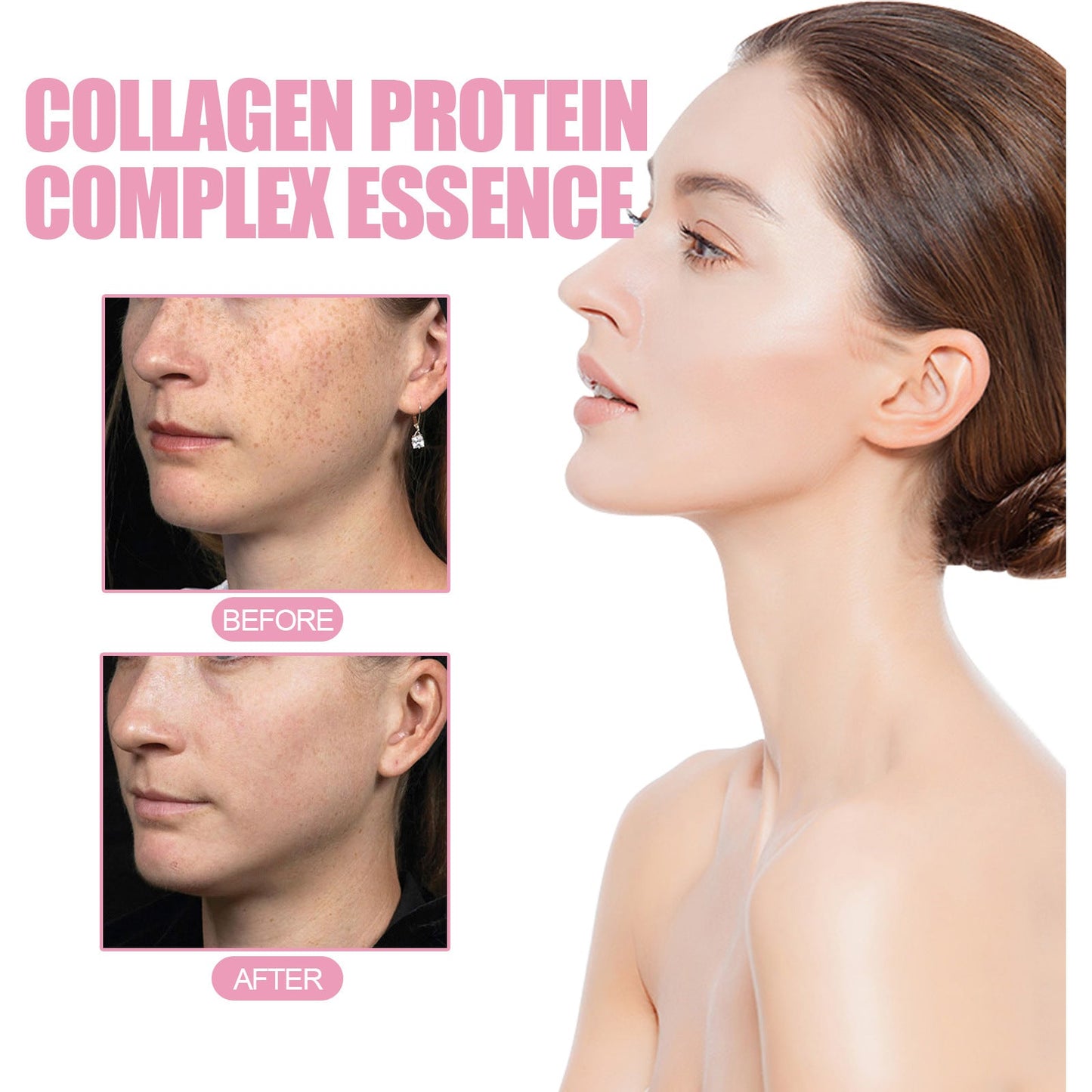 EELHOE Sheep Placenta Collagen Essence Firms , លើក , បាត់ស្នាម , ធ្វើអោយប្រសើរឡើងនូវពណ៌ស្បែក , ផ្តល់សំណើមដល់ការថែរក្សាស្បែក 