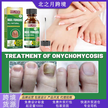 EELHOE onychomycosis repair liquid toenail tea tree oil finger thick soft nail nutrition hand and foot nail care liquid 