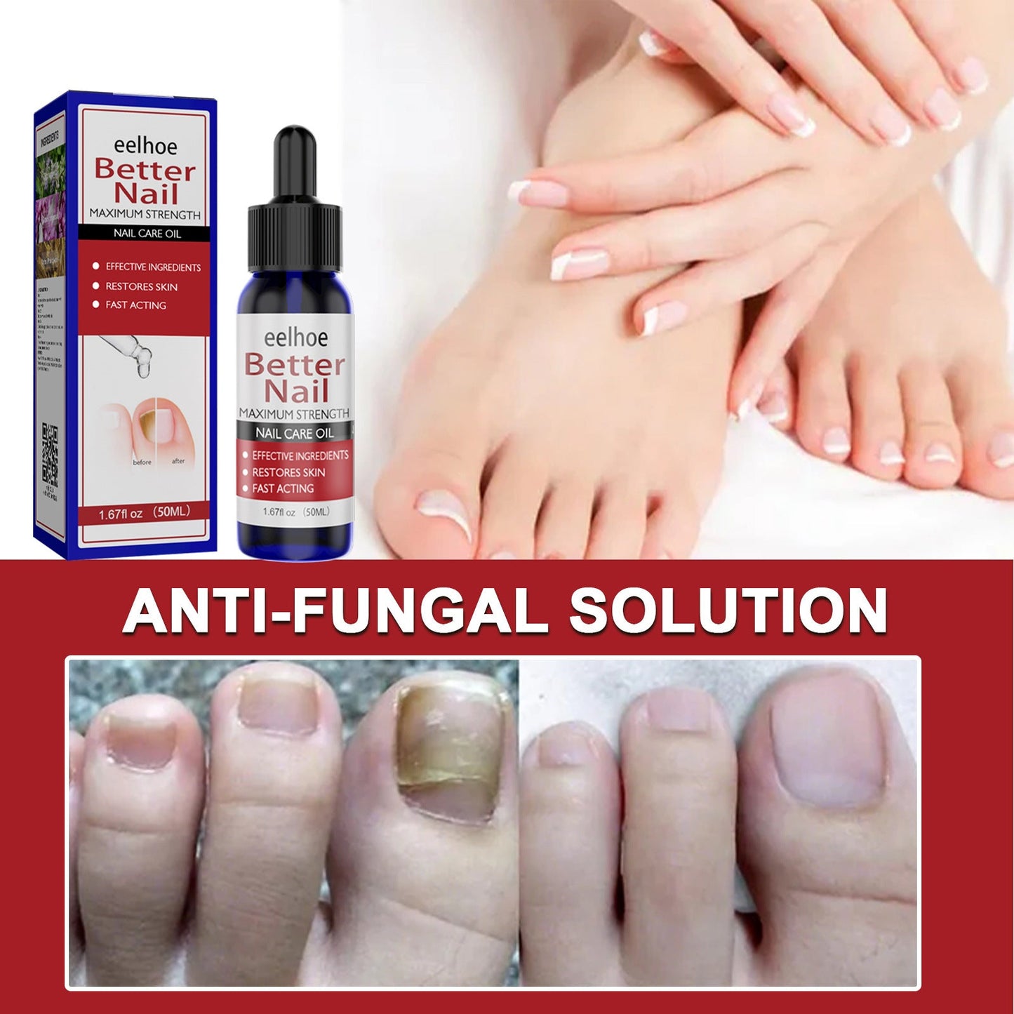 ដំណោះស្រាយជួសជុលក្រចក EELHOE Nail Care Hands and Feet Nail Repair Moisturizing Cleansing Onychomycosis Nail Repair Solution 