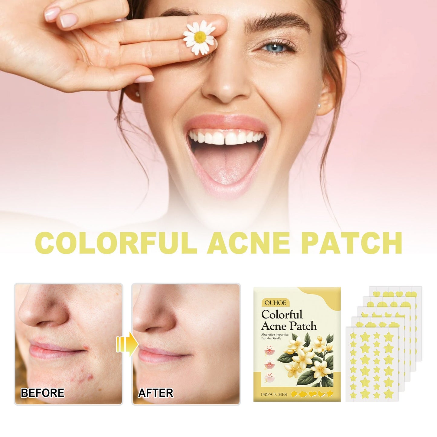 OUHOE yellow acne patch repairs facial skin, fades acne, blackheads, closed comedones, smooth skin, oil control, moisturizing 