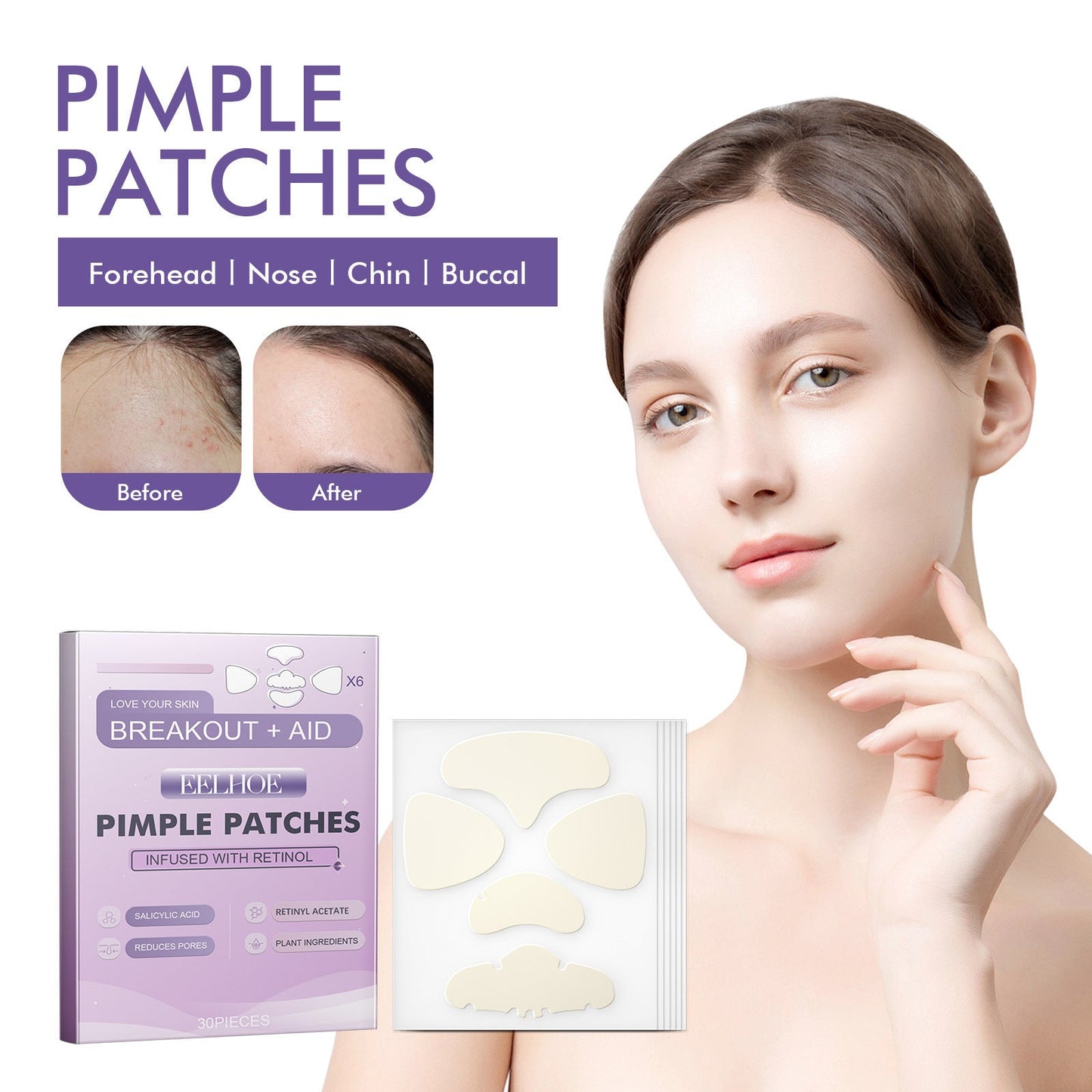 EELHOE Cheek acne patch salicylic acid anti-acne fade acne marks acne closed mild cleansing acne patch 