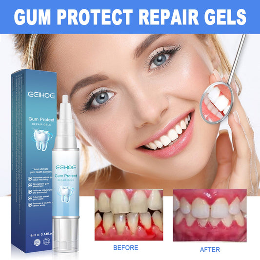 EELHOE Teeth Repair Gel ជួសជុលអញ្ចាញធ្មេញ ហើម និងឈឺ សំអាតធ្មេញបានជ្រៅ និង tartar Oral Care Gel 