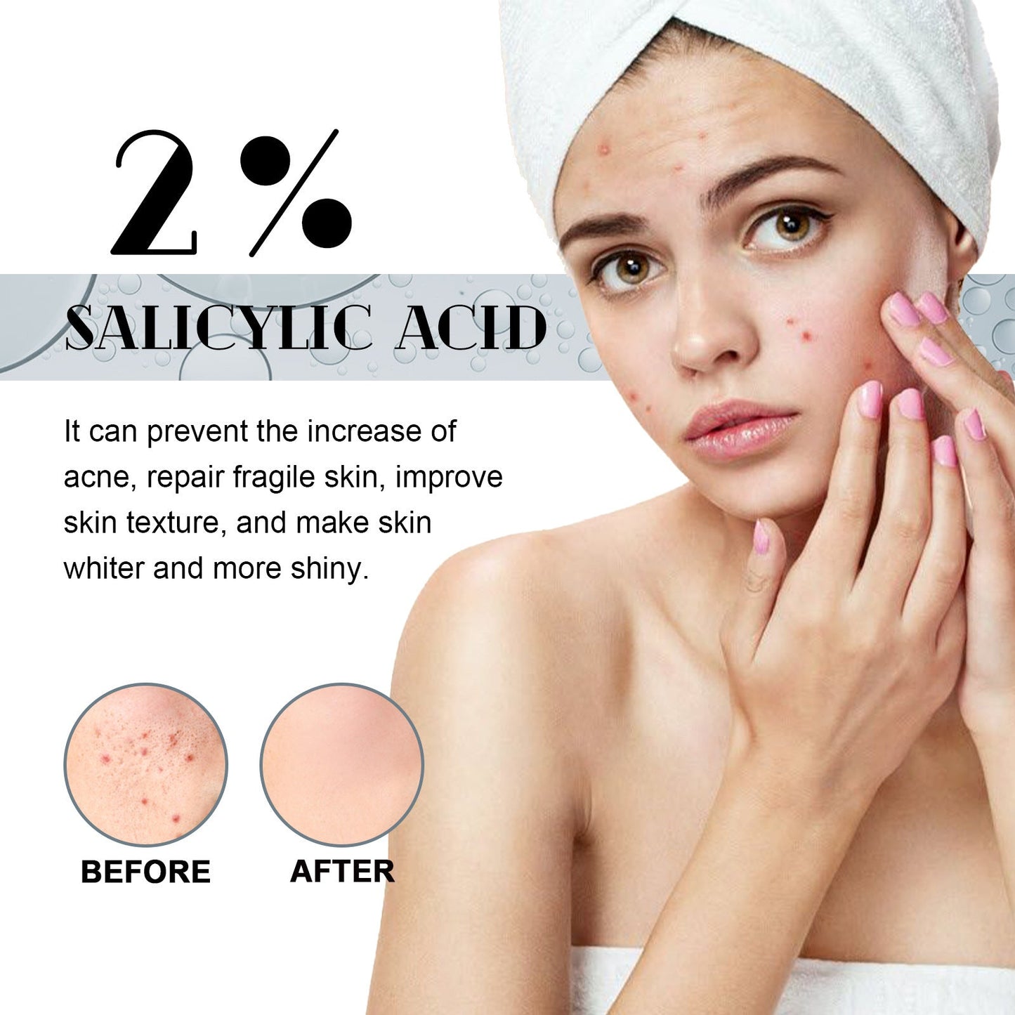 West Month Salicylic Acid Facial Essence, បាត់ស្នាមមុន, ជួសជុល, ផ្តល់សំណើម និងផ្តល់សំណើមដល់ស្បែកមុខ Essence 