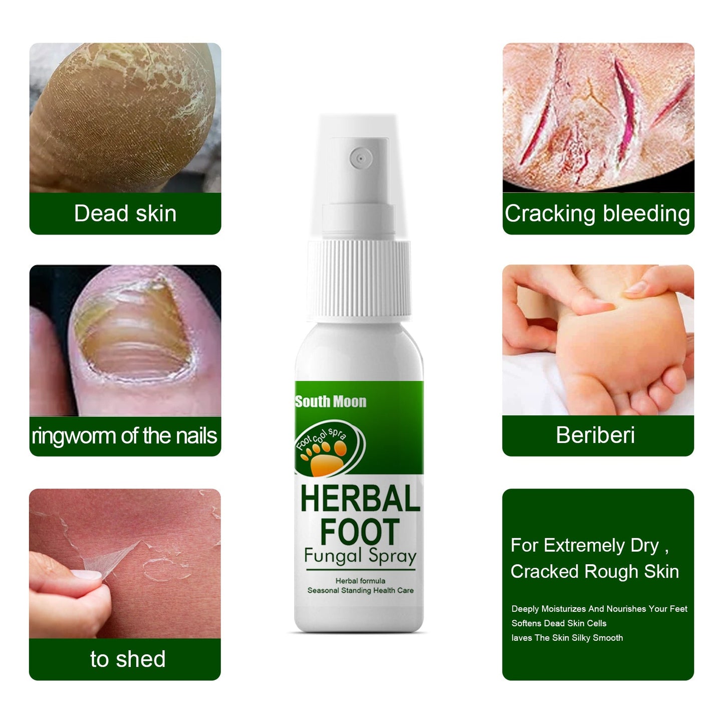 South Moon Herbal Foot Spray បាញ់បំបាត់ការរមាស់ជើងរបស់អត្តពលិក Deodorizing Peeling Foot Care Spray 