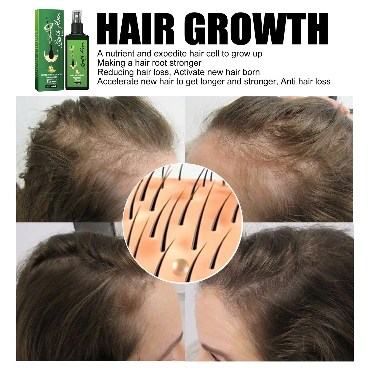 South Moon Hair Nutrition Spray ពង្រឹងសក់ ផ្តល់សំណើម ការពារសក់ជ្រុះ ដំណោះស្រាយថែរក្សាស្បែកក្បាល 