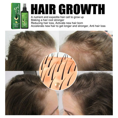 South Moon Hair Nutrition Spray ពង្រឹងសក់ ផ្តល់សំណើម ការពារសក់ជ្រុះ ដំណោះស្រាយថែរក្សាស្បែកក្បាល 