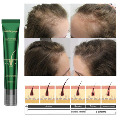 South Moon Anti-hair loss treatment solution strengthens hair, prevents hair breakage, ginger hair root care, damage repair 