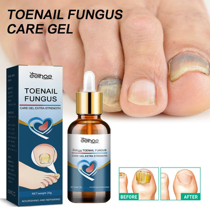 EELHOE Toenail Care Gel Yellow and Thickened Hand and Foot Nails Soft Nail Polishing Nail Care Gel 