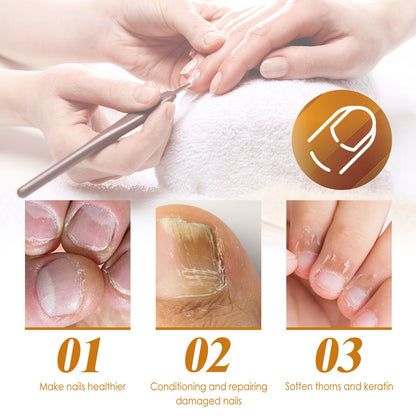 EELHOE Instant Cuticle Care Gel Repair Onychomycosis, ក្រចកទន់, ក្រចករលួយ, ដំណោះស្រាយថែរក្សាស្បែកដែលមានសំណើម 