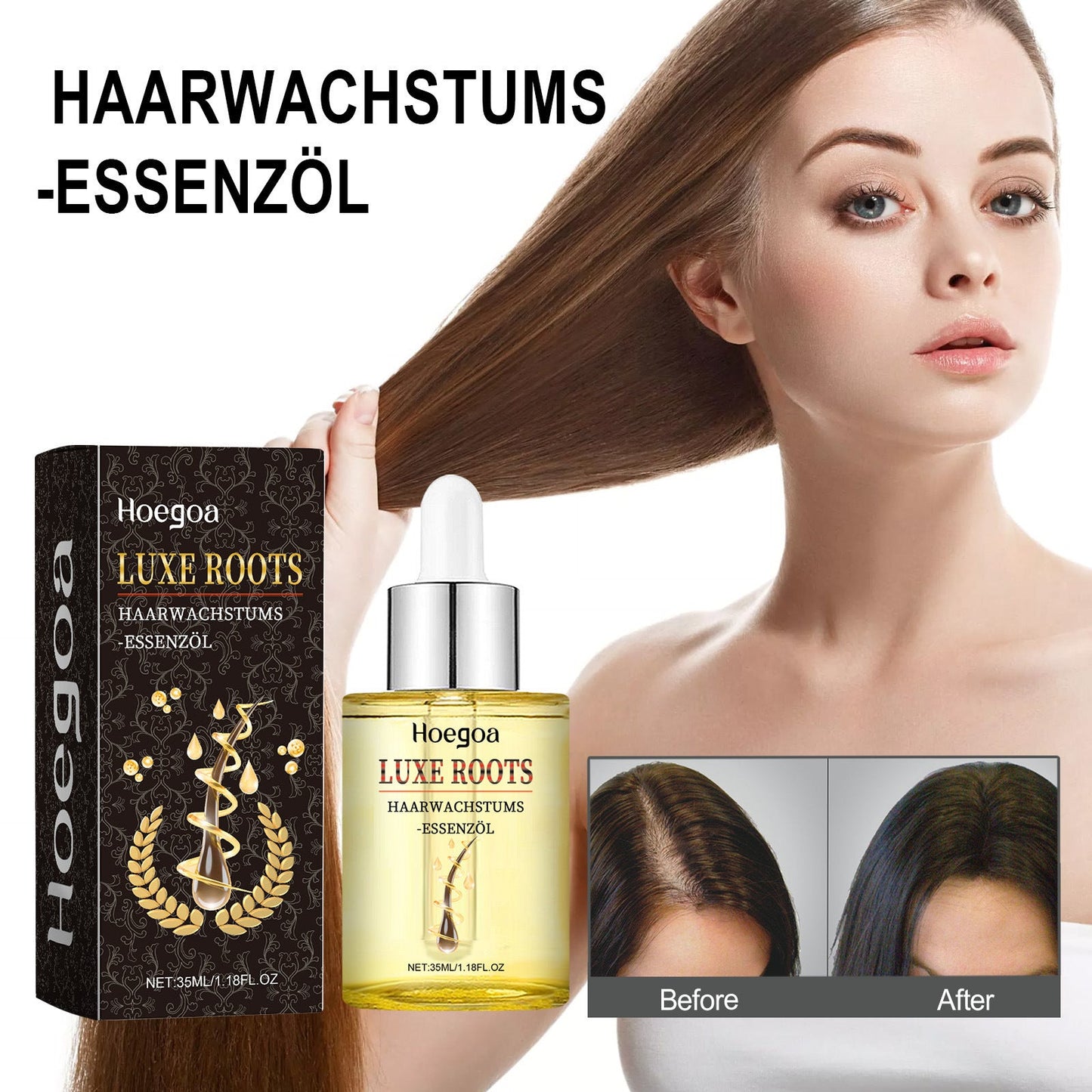 Hoegoa Thick Hair Essence ម៉ាស្សាស្បែកក្បាល ការពារការជ្រុះសក់ ធ្វើអោយសក់រឹងមាំ មានសំណើម ទន់រលោង និងមានបរិមាណច្រើន សក់ក្រាស់ ប្រេងសំខាន់ៗ 